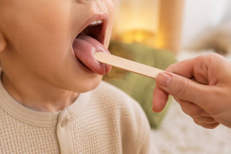 Bas du visage d'un enfant bouche ouverte avec un abaisse-langue en bois pour examiner la langue