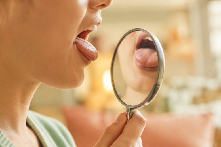 Close-up profile of an open mouth checked with a small round mirror, unidentifiable face